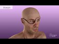 Aaron James's Partial-Face & Total-Eye Transplant Surgical Animation, 2023