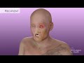 Aaron James's Partial-Face & Total-Eye Transplant Surgical Animation, 2023