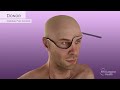 Aaron jamess partialface  totaleye transplant surgical animation 2023