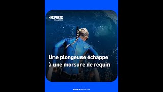 Une plongeuse échappe à une morsure de requin Une plongeuse échappe à une morsure de requin
