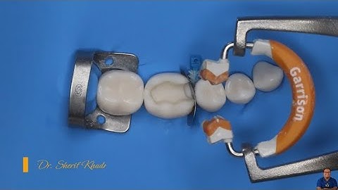Sectional Matrix Placement Technique