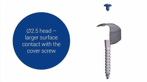 GBR with Customised Titanium Mesh and Tenting Screw by Bionnovation