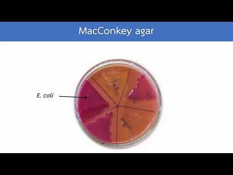 MacConkey agar หลักการ วิธีการอ่านผล : HCU