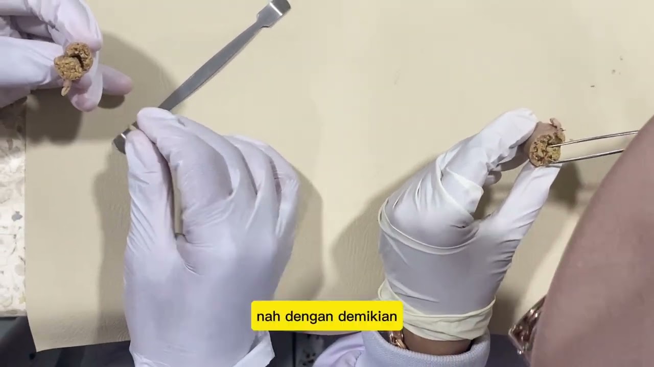 Menghitung Diameter telur