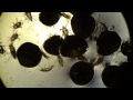 Клещи Под Микроскопом: Клещ Пузатый Pediculoides ventricosus. Grain Itchy Mite Under Microscope.