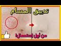 طريقه لسد مسامات الوجه من اول مره و تبييض الوجه من اول استعمال 