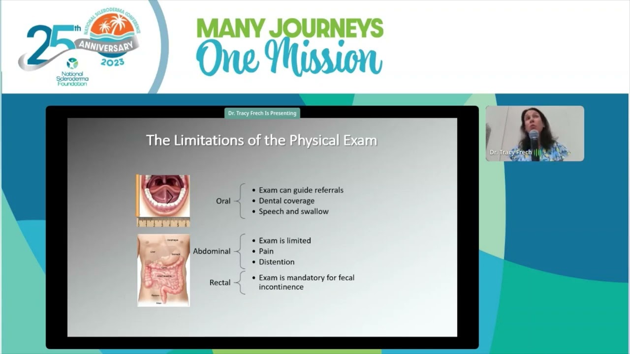 Navigating GI Issues in Scleroderma, Tracy Frech, MD, MS