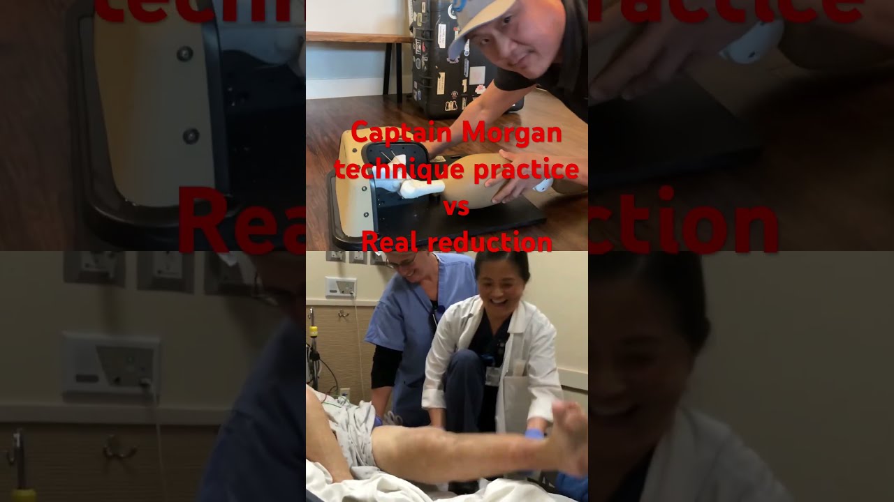 Practice Vs Real Reduction How To Reduce Hip Dislocation Orthopedic Emergencymedicine