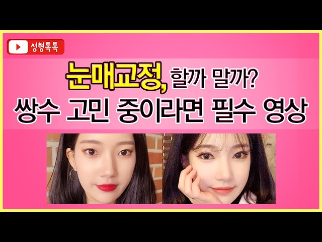 [성형톡톡] 눈매교정 할까말까? 쌍수 고민 중인 분들께 딱 정리해주는 영상! 절개 vs 비절개 눈매교정
