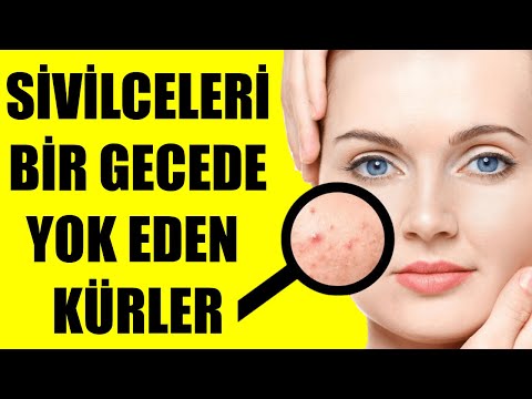 Video: Kabarık Meme Ve Sızan Sütü: Gebelikte Göğüsler Şaşırtıcı Şekiller