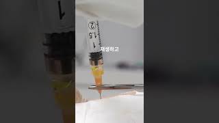 퇴행성관절염치료법 줄기세포치료법 #퇴행성관절염 #줄기세포치료 #줄기세포주사#관절염치료 #관절통 #관절염 #노인건강 #미국이민 #엘에이한인교회
