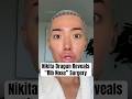 Nikita Dragun Reveals “Rib Nose” Surgery #shorts #NikitaDragun #NikitaDragunSurgery
