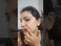Face PRP | A Day In My Life #shorts #minivlog #adayinmylife #dailyvlog #prp #faceprp