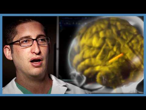Chris Clare Was Sent Home With An 8CM Pin In His BRAIN! | Body Invaders
