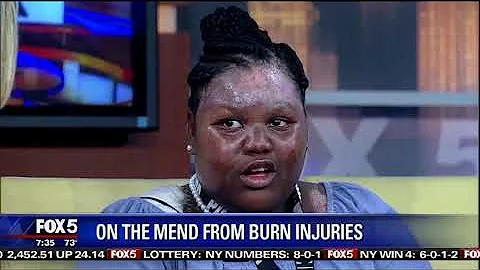 11-year-old girl burned with hot water at sleepover