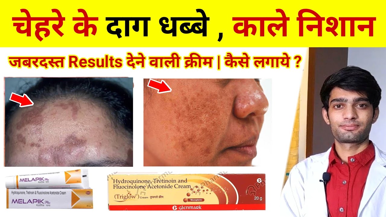 melapik cream scar removal cream chehre ke daag dhabbe kaise hataye