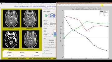 Brain Tumor Detection using convolutional neural network (CNN) Matlab project code
