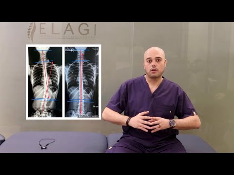 الفرق بين العلاج الطبيعي و التأهيل فيديو هام جدا    