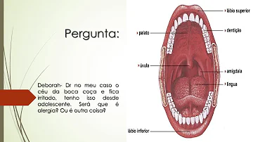O que causa irritação no céu da boca?