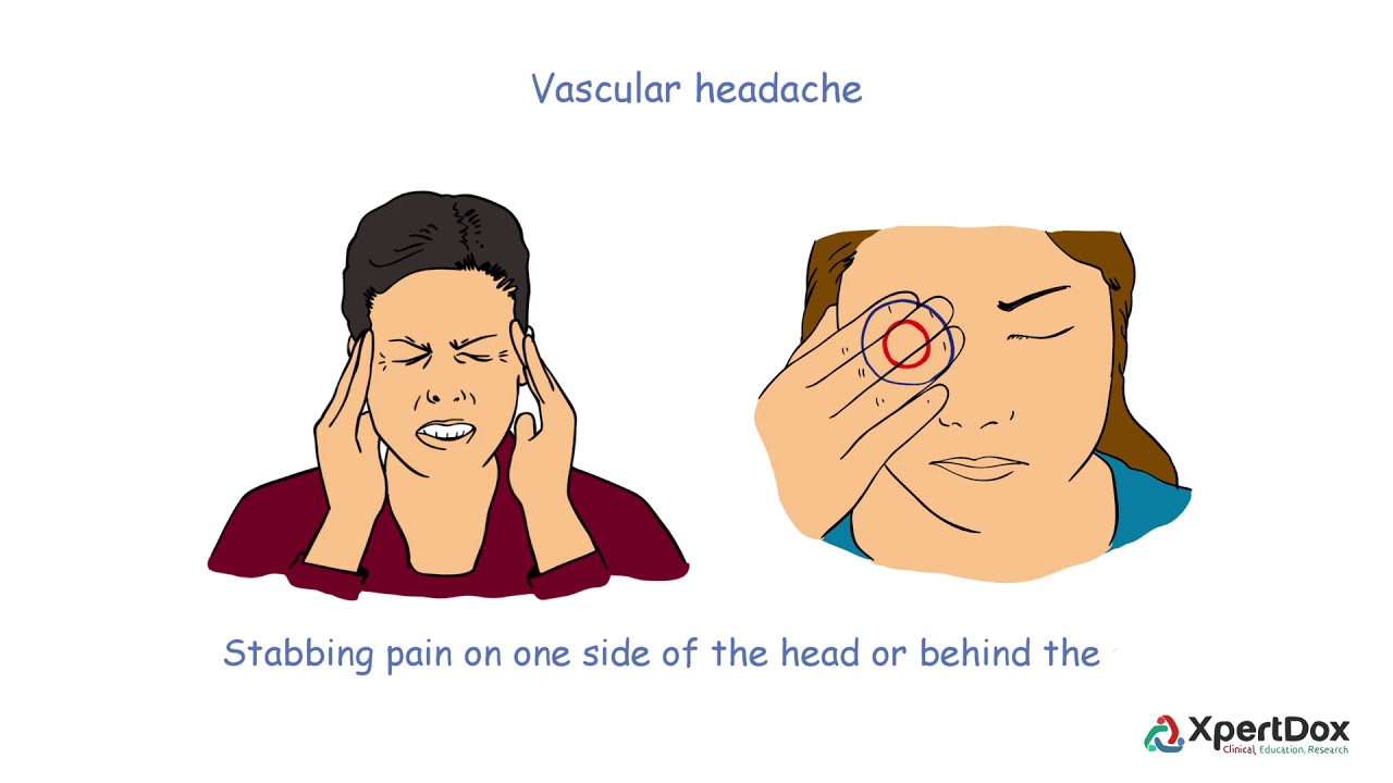 What Is Vascular Headache