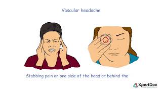 What Is Vascular Headache