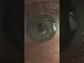 Macro Eye