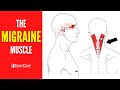 How to Release Tension for FAST MIGRAINE RELIEF