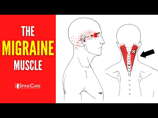 Migraine Support and Fast Headache Relief