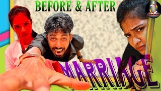 Before & After Marriage - Sothanaigal | Pavithiran | Thageetzz