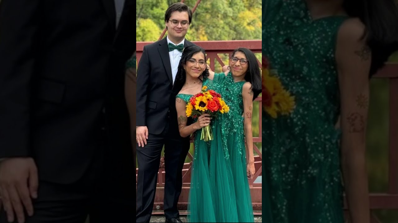 Breaking Conjoined Twin Carmen Andrade Just Got Married 