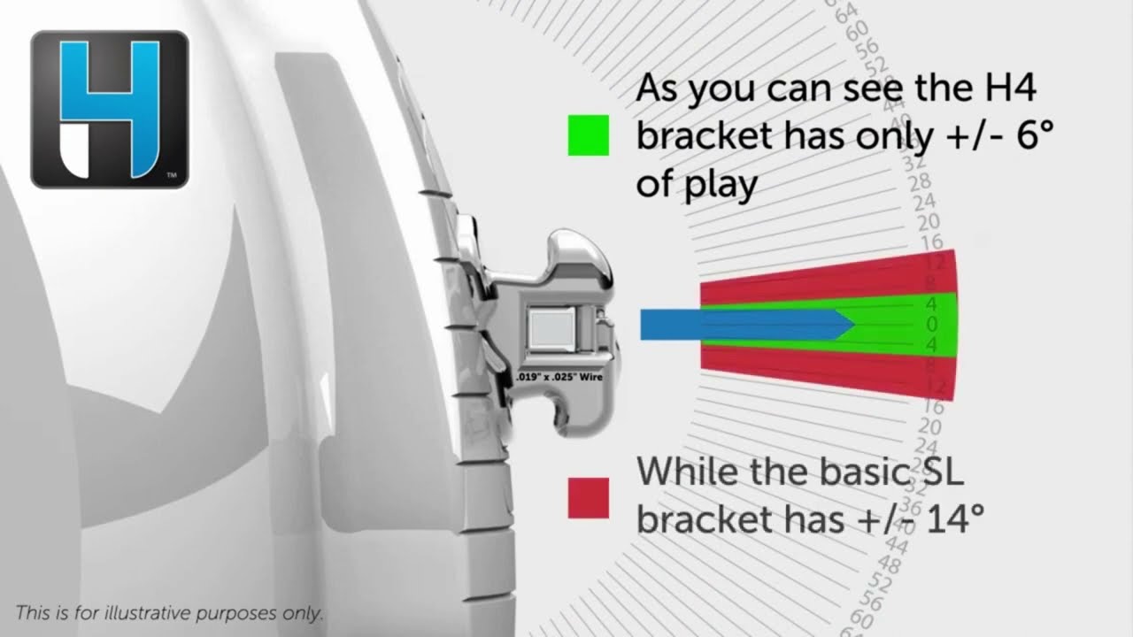 H4 Self Ligating Bracket System - XBD