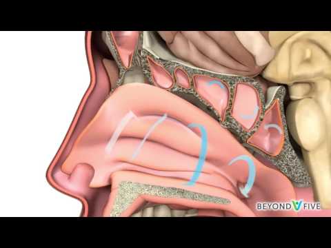 Vídeo: Càncer Nasal I Sinusal (carcinoma De Cèl·lules Escamoses) En Gats