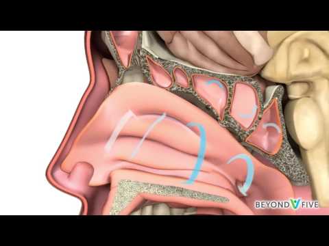 Vídeo: Càncer Nasal I Sinusal (carcinoma De Cèl·lules Escamoses) En Gossos