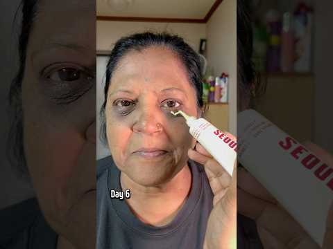 mid dermal tightening