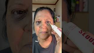 Transformation in 7 days by using RETINAL eye cream! #southkorea #koreanskincare #skincare #kbeauty