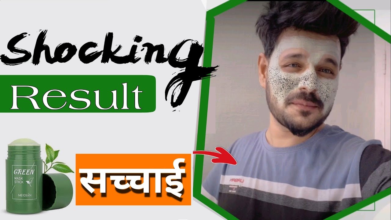 Green mask stick review in Hindi How to use Green mask stick cream