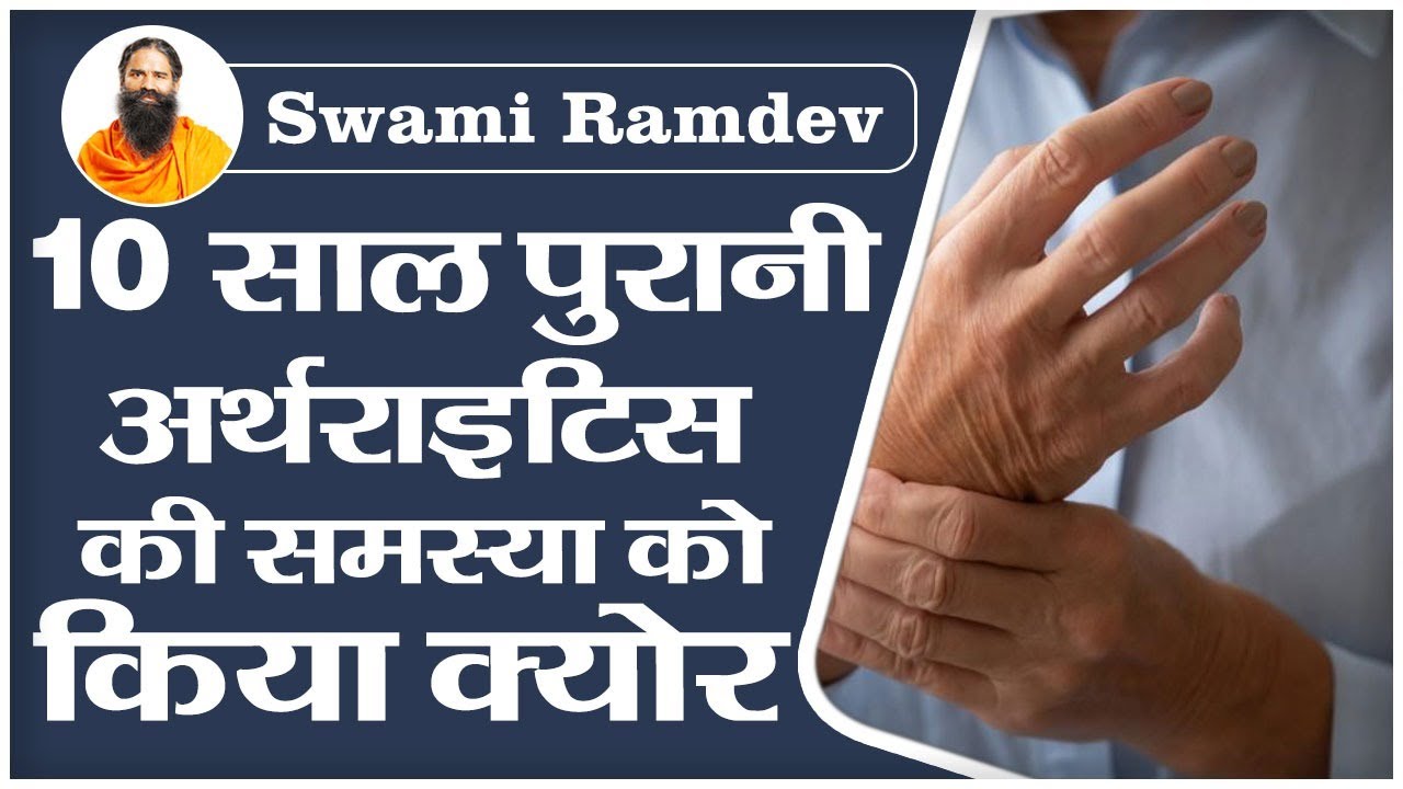 10 साल पुरानी अर्थराइटिस (Arthritis) की समस्या को किया क्योर Swami