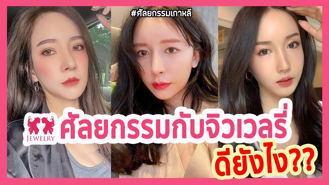 ศัลยกรรมเกาหลี | Jewelry Plastic Surgery รวมรีวิวศัลยกรรมเปลี่ยนชีวิต ศัลยกรรมเกาหลี | Jewelry Plastic Surgery รวมรีวิวศัลยกรรมเปลี่ยนชีวิต