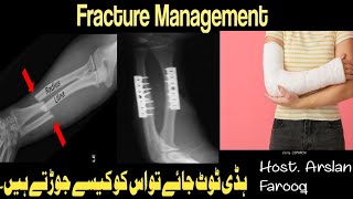 Radius Ulna Fracture Management | #fracture#ulna#orthopedicshortcase#orthopedicsurgeons#surgeryday