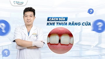 Những Cách Khắc Phục Khe Thưa Răng Cửa Bạn Cần Biết | Nha Khoa Minh Châu