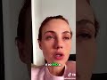 Orticaria Post-Infettiva? Il Cervello non mi dà Pace! #shorts