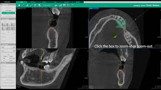 Ez3D-i | MPR Tab | Simulation