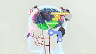 Neuro 3 | Brain PBM Visualization (Default Mode Network Stimulation)