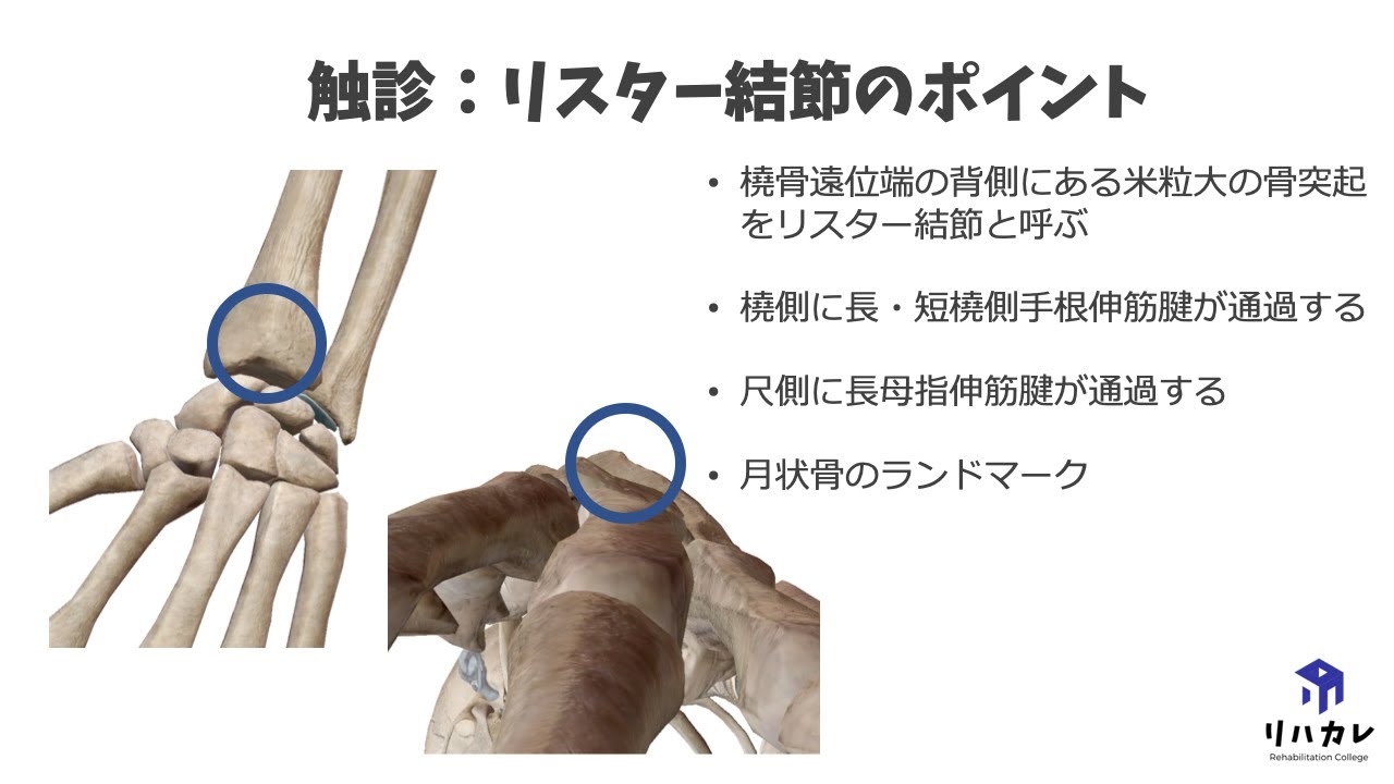 リスター 結節 と は