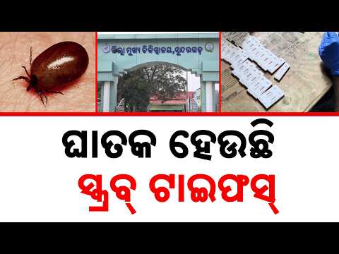 Scrub Typhus Cases Surge Past 900 In Sundargarh; 24-Hour Control Room Opened | Argus News