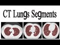 CT lungs segments