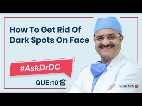 Get Rid Of Dark Spots On Face(चेहरे के काले धब्बों से छुटकारा पाएं)| #AskDrDc Ep 10 | (In HINDI)