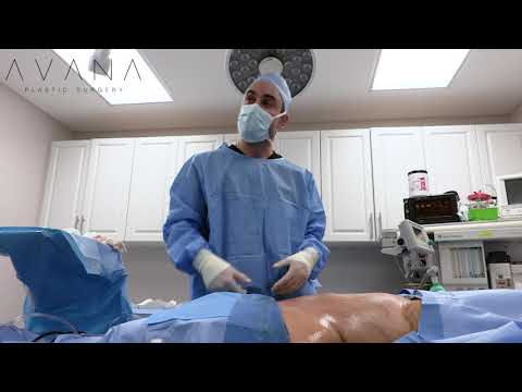 Lipo 360 by Dr Moradian - Amalia Reality