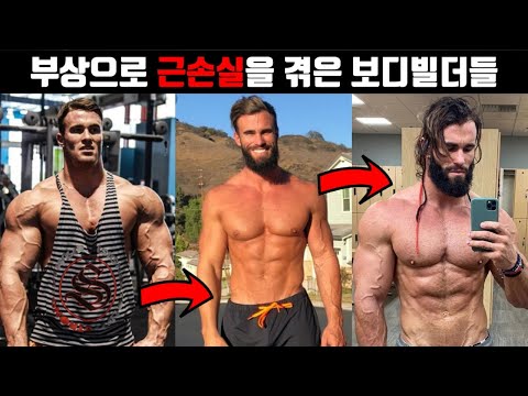 부상으로 근손실을 겪은 보디빌더들