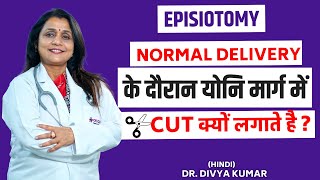 What Is Episiotomy? Episiotomy Is Different Than Other Operations? By Dr. Divya Kumar